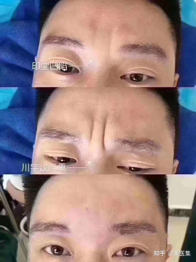 imtoken小矿工_imtoken怎么激活矿工_imtoken矿工费如何获得